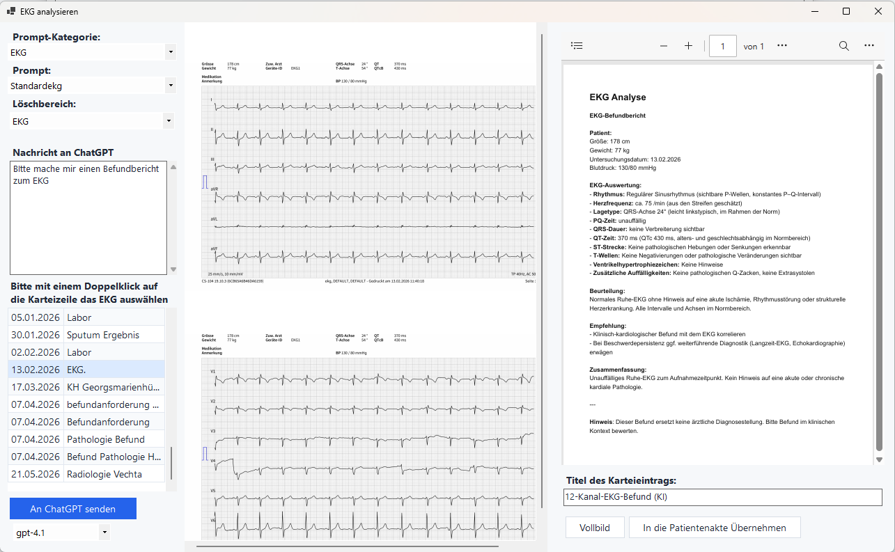EKG-Analyse im Euvejo