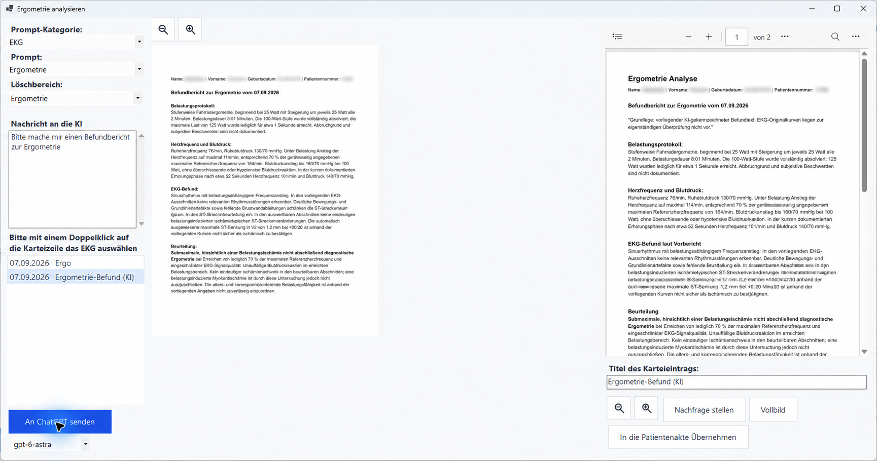 Ergometrie-Analyse im Euvejo