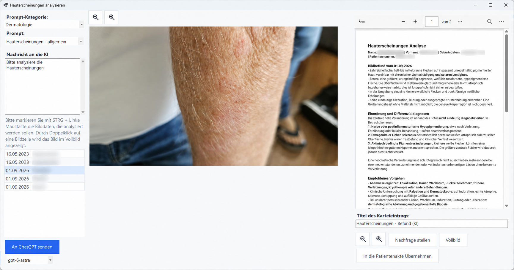Hauterscheinungs-Analyse im Euvejo